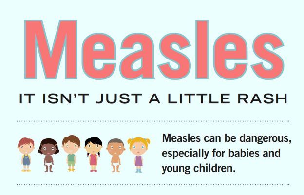 measles